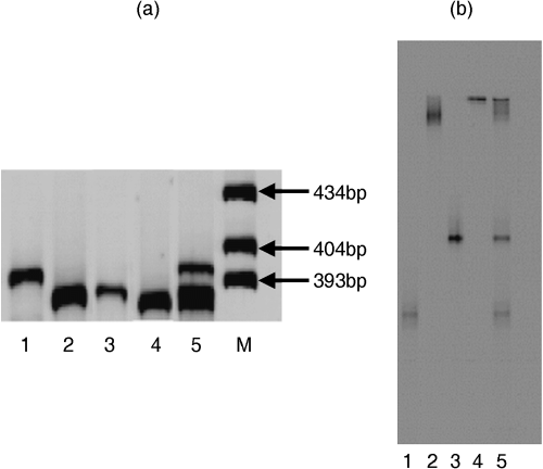 Figure 2  (a) Size separation and (b) denaturing gradient gel electrophoresis (DGGE) patterns of the bacterial 16S rDNA amplified with primer set I. Lane 1 B. subtillis, lane 2 M. odoratus, lane 3 A. baumannii, lane 4 F. aquatile and lane 5 bacterial mix. Lane M in (a) is the size marker.