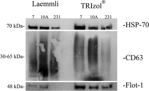 Figure 2. Verification of EV isolation. Laemmli and TRIzol©-extracted samples were interrogated by Western blot for the expression of the canonical EV markers HSP-70, CD63, Flotillin-1, CD81 and CD9. MCF-7 (7), MCF-10A (10A) and MDA-MB-231 (231) cell EVs were examined. HSP-70 (top), CD63 (middle) and Flotillin-1 (bottom) were detected in the isolated EVs.