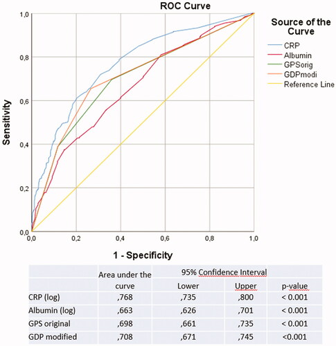 Figure 2. ROC curves showing areas under the curve for CRP, albumin, original and modified Glasgow Prognostic Scores in relation to cancer specific survival.