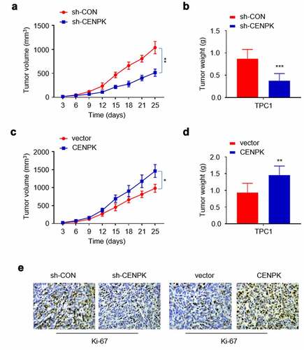 Figure 5. Influence of knockdown and overexpression of CENPK suppresses DTC tumor growth in vivo