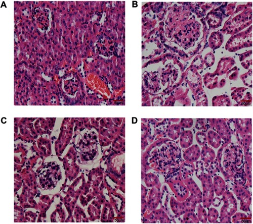 Figure 6 Effect of quercetin on renal structural alterations after administration for 10 weeks. Representative photomicrographs of H&E staining in kidney sections (bar =50 μm in the field). (A) db/m mice; (B) db/db control mice; (C) LD-quercetin treated db/db mice; (D) HD-quercetin treated db/db mice.
