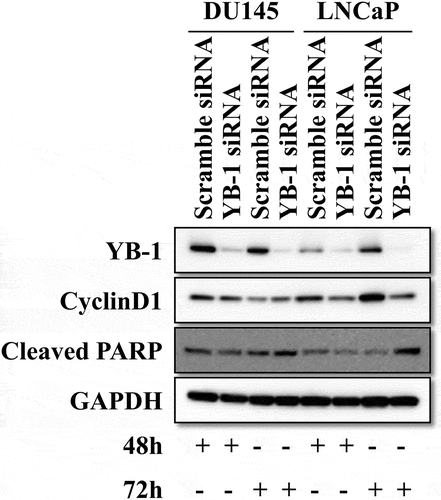Figure 1. Knockdown of YB-1 suppresses cyclinD1 and upregulates cleaved PARP expression. DU145 and LNCap cells were transfected with a Scramble siRNA or a YB-1 siRNA for 48 h and 72 h. Western blot analysis was performed to assess the expression of YB-1, cyclinD1 and cleaved PARP; GAPDH served as the internal control. A representative image of at least three independent experiments with similar results is shown