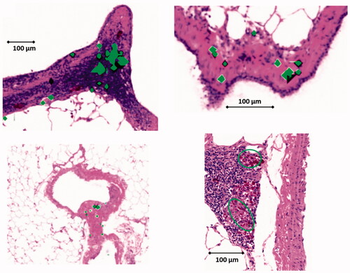 Figure 6. CeO2 NP agglomerates were correlated with identical histopathological light microscope image using ToF-SIMS analysis. (A–D) show overlay pictures (500 µm × 500 µm) consisting of ToF-SIMS signal for CeO2 NP (green) and their corresponding histopathological images. CeO2 NPs are associated with the BALT (bronchus-associated lymphoid tissue); (a total of 36 pictures were analyzed at 24-month time point, images of dose Group #4 are shown).