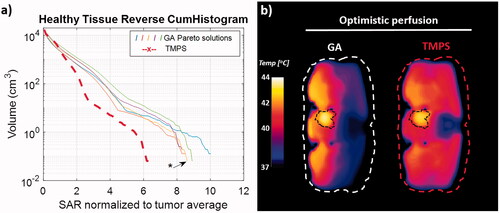 Figure 9. Treatment of bladder tumor with 100 MHz 4-element applicator: (a) healthy tissue SAR histograms of five Pareto-optimal solutions from GA optimization and from TMPS optimization (the GAs are colored as in Figure 4 and the configuration closest to the center of the TMPS selection region is indicated); (b) axial temperature distribution cross-sections through the tumor (optimistic perfusion model).