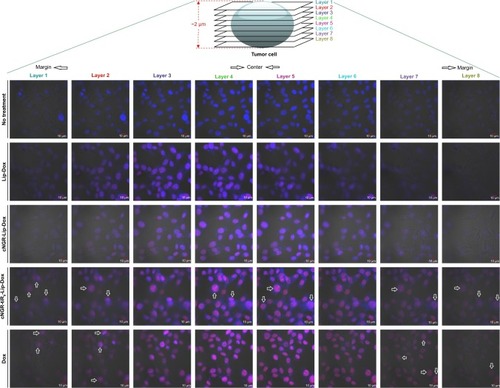 Figure 7 Representative cell uptake visualized using confocal laser-scanning microscopy.Notes: HT1080 cells were recorded after incubation with free Dox, Lip-Dox, cNGR-Lip-Dox, and cNGR-tiR9-Lip-Dox (Dox 2.5 µg/mL) at 37°C for 24 hours. Cells were fixed with 4% paraformaldehyde. Merged bright-field, Hoechst 33258 (blue), and drug-fluorescence (red) images were documented.Abbreviations: cNGR, cyclic asparagine-glycine-arginine; Dox, doxorubicin; Lip, liposomes; tiR9, tandem-insert nona-arginine.