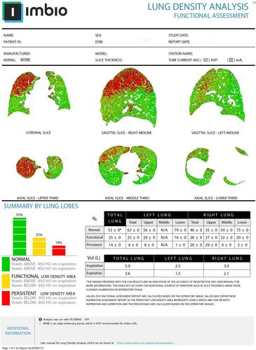 Figure 3 Representative clinical report that contains PRM images in all orientations and summary statistics from a COPD patient, courtesy of Imbio.