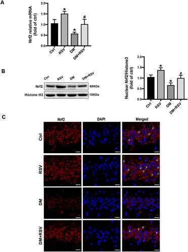 Figure 6 RSV upregulates Nrf2 expression in the hippocampus. (A) The mRNA level of Nrf2 in the hippocampus of mice was measured by qRT-PCR. (B) The expression of Nrf2 nuclear protein in the hippocampus was determined by Western blot. (C) The activation of Nrf2 was analyzed by the immunofluorescence staining of hippocampal tissue sections. Nrf2 (red), nuclear staining by DAPI (blue), and nuclear accumulation (indicated by white arrows). The merged image shows the nuclear localization of the Nrf2 protein (scale bar = 20 μm). The data are expressed as the mean ± SD (n = 3). *P < 0.05 vs Ctrl; #P < 0.05 vs DM.Abbreviations: qRT-PCR, quantitative real-time PCR; DAPI, 4,6-diamidino-2-phenylindole.