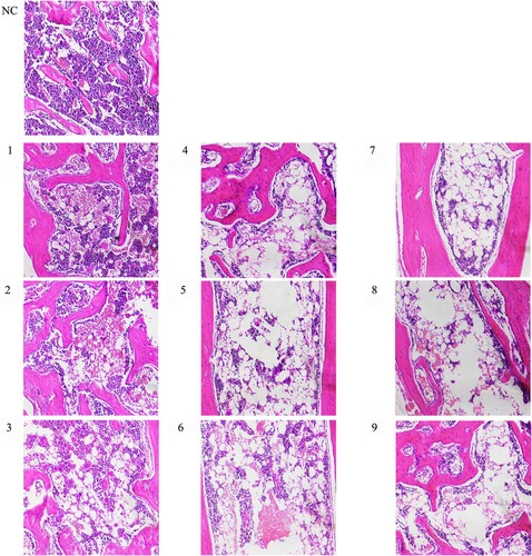 Figure 5. Morphological changes of bone marrow. Hematoxylin-eosin-stained bone marrow sections were observed under an inverted microscope and photographed at 200× magnification. Karyocytes were stained blue with hematoxylin, while erythrocyte and bone trabecula were stained red with eosin. The system, including granulocytes, erythrocytes, megakaryocytes and lymphocytes, was regarded as hematopoietic tissue; meanwhile, bone trabecula, bone and adipose tissue belonged to the non-hematopoietic tissue.