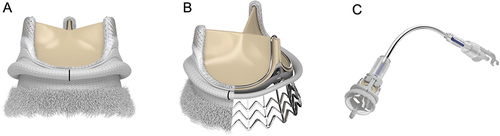 Figure 2 Representative product images of rapid deployment valve (Edwards INTUITY Elite Valve System) with permission from Edwards Lifesciences, Irvine, CA, USA. It is composed of three bovine pericardial leaflets and a subannular balloon-expandable skirt, which works as an anchor and seal of the stent. (A) External view, (B) Subannular skirt, (C) Delivery system. Courtesy of Edwards Lifesciences.