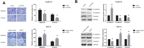 Figure 3 HCP5 promotes OSCC cell migration, invasion and EMT. (A) Migration and invasion of OSCC cells after transfection, detected by transwell assay. (B) Western blot analysis of EMT-related proteins in OSCC cells after transfection. Data are presented as mean ± SD. *P<0.05 versus si-NC or empty vector-transfected cells.