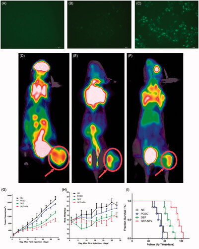 Figure 2. In vitro cellular uptake of PCEC polymeric micelles (A–C), example of each group mice on PET imaging (D–F) and evaluation of antitumor efficiency(G–I) A: blank control; B: The mixture of Coumarin-6 and PCEC; C:Coumarin-6-labeled PCEC nanoparticles (×400); (D):NS group, (E):GEF group, (F):GEF-NPs group; Evaluation of antitumor efficiency in vivo (G) and body weight changes (H) after treatment on A549 tumor-bearing nude BALB/c mice. Each point represents the mean of tumor size ± SD (6≤N ≤ 12). (I): The fraction survival of each group.