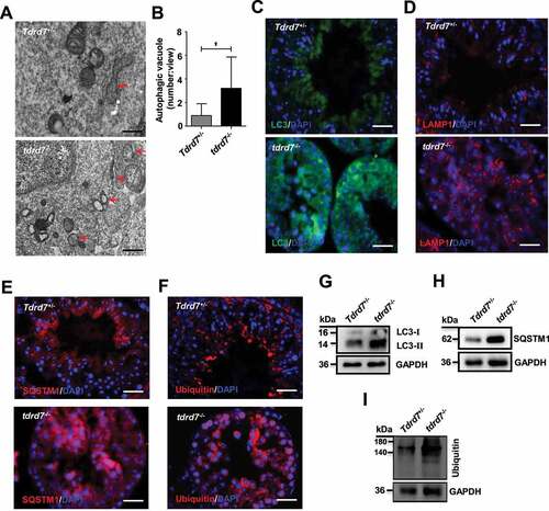 Figure 7. Evaluation of Tdrd7+/− and tdrd7−/− seminiferous tubules. (A) Detection of Tdrd7+/− and tdrd7−/− mice testes using TEM. The red arrows indicate the autophagic vacuoles. (B) Quantification of the average number of autophagic vacuoles in Tdrd7+/− and tdrd7−/− mice testes using TEM analysis. *P < 0.05. (C-F) Immunostaining of Tdrd7+/− and tdrd7−/− seminiferous tubules for LC3 (C), LAMP1 (D), SQSTM1 (E), and ubiquitin (F) (red signal). The nuclei were stained with DAPI (blue signal). Scale bar: 50 μm. (G-I) Immunoblotting analysis of Tdrd7+/− and tdrd7−/− testicular tissue for LC3 (G), SQSTM1 (H), and ubiquitin (I) confirmed the accumulation of LC3-II, SQSTM1, and ubiquitin protein in tdrd7−/− seminiferous tubules