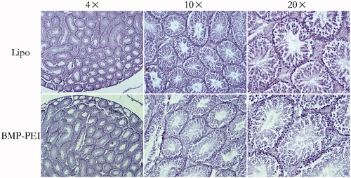 Figure 5. Histochemistry evaluation of the structures of testes that performed TMGT. The results showed that no obvious histological destructions based on seminiferous tubules was observed in the testes of both BPD and Lipo-DNA groups.