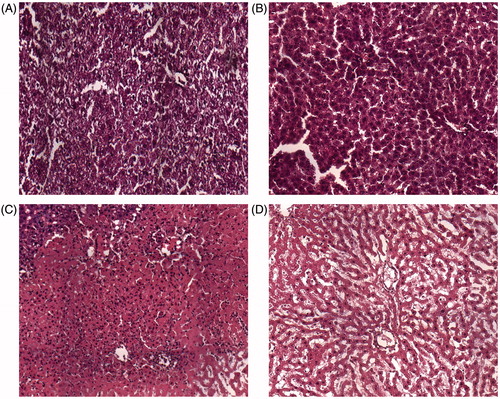 Figure 3. Histological appearance of liver tissues immediately after microwave ablation. (A) The tissue directly adjacent to the needle during microwave ablation. (B) The central zone consists of damaged liver tissue. (C) Normal architecture and inflammatory cells are observed in the transition zone. (d) Normal liver tissue. Magnification ×200.