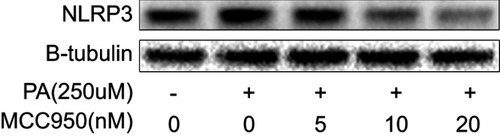 Figure S3 The NLRP3-inflammasome can be activated by PA treatment and inhibited by MCC950 in a concentration-dependent way in HepaRG cell line. Western blot of NLRP3 in HepaRG indicated that PA treatment activates NLRP3 inflammasome, which could be suppressed by MCC950.