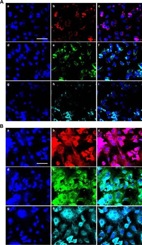 Figure 4 Adipose-derived stem cell osteogenic differentiation on the membranes in vitro.Notes: (A) Adipose-derived stem cell (ADSC) osteogenic differentiation on the membranes after 2 weeks: a, b, and c show osteocalcin (OCN) protein staining; d, e, and f show osteoproteoglycan (OPG) protein staining; g, h, and i show osteopontin (OPN) protein staining; a, d, and g show 4′,6-diamidino-2-phenylindole (DAPI) staining; b, e, and h show antibody staining; and c, f, and i are the merged images. Scale bar, 50 μm. (B) ADSC osteogenic differentiation on the membranes after 4 weeks: a, b, and c show OCN protein staining; d, e, and f show OPG protein staining; g, h, and i show OPN protein staining; a, d, and g show DAPI staining; b, e, and h show antibody staining; and c, f, and i are the merged images. Scale bar, 50 μm.