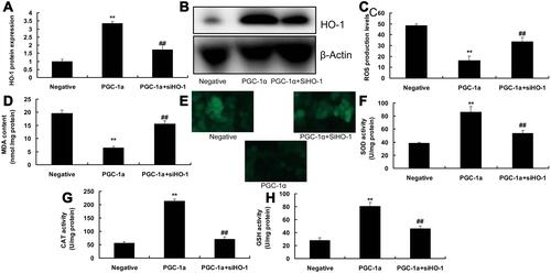 Figure 6 Suppression of HO-1 participated in the function of PGC-1α in Diabetes mellitus with myocardial infarction. HO-1 protein expression (A and B), ROS production levels (C and D), MDA SOD, CAT and GSH activity levels (E–H). Negative, negative group; PGC-1α, over-expression of PGC-1α group; PGC-1α+ si-HO-1, over-expression of PGC-1α and down-regulation of HO-1 group. **p<0.01 versus negative group, ##p<0.01 versus over-expression of PGC-1α group.