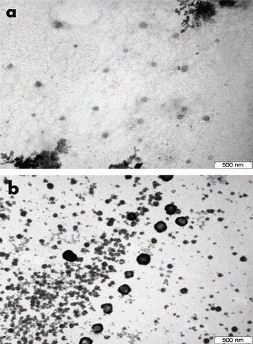 Figure 5 TEM micrographs of SUV (a) and MLV (b) liposomes. Scale bar 500 nm.