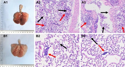 Figure 8 (A1 and B1) The image of whole lung and (A2–A3 and B2–B3) the lung under light microscope treated with either nebulized (A2–A3) 0.9% NaCl or (B2–B3) 0.1 mg/mL PLGA-PEG/PFOB emulsion. (Red arrows: inflammatory cells aggregating; black arrows: congested capillaries of the alveolar wall).Note: The magnification is ×200.Abbreviations: PLGA-PEG, poly(lactide-co-glycolide)-poly(ethylene glycol); PFOB, perfluorooctyl bromide.