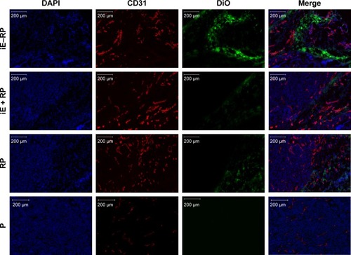 Figure 4 Immunofluorescence images of tumor tissue slices in four groups (iE–RP, iE + RP, RP, and P) at 24 h postinjection.Notes: DiO-labeled nanoparticles (green), CD31-labeled blood vessels (red), and DAPI-labeled cancer cells are shown in the images of tumor sections. Scale bar =200 µm.Abbreviations: DiO, 3,3′-dioctadecyloxacarbocyanine perchlorate; iE–RP, iE-RBCm-PLGA NPs; iE+RP, RBCm-PLGA NPs with free anti-EGFR-iRGD protein; RP, RBCm-PLGA NPs; P, PLGA NPs.