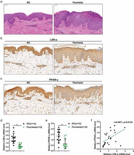 Figure 1. Distribution and protein levels of LXR-α and PPAR-γ in tissue samples (a) Pathological analysis of psoriasis lesion and nonlesion tissues using hematoxylin and eosin (H&E) staining. (b-c) The distribution and protein levels of LXR-α and PPAR-γ in psoriasis lesion and nonlesion tissues determined by immunohistochemical (IHC) staining. (d-e) The mRNA expression of LXR-α and PPAR-γ in psoriasis lesion (n = 12) and nonlesion tissues (n = 12) was determined by real-time PCR. (f) The correlation of LXR-α and PPAR-γ expression. **P < 0.01.