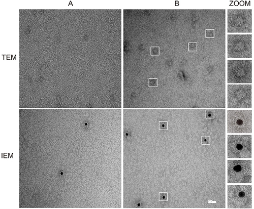 Figure 4 TEM and IEM analyzes of Fe-H11-D4 and electron microscopic observation of the nanoparticles. (A) Electron microscopic observation of E. coli expressing Fe-H11-D4. (B) Electron microscopic observation of Fe-H11-D4 expressed by silkworm (suitable diluted). Scale bar is 100 nm.