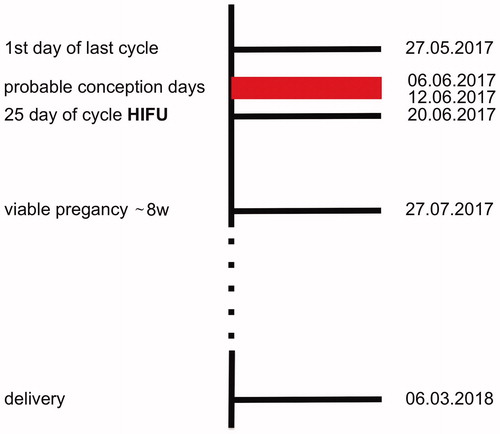 Figure 5. Case report timeline. The MR-HIFU was performed between 8 –12 days after the probable day of conception, according to the last menstruation, and 10 days after conception according to the ultrasound exam.
