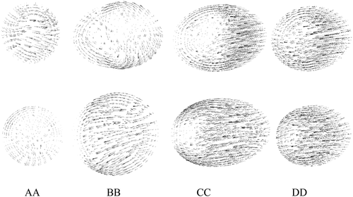 Figure 11. In-plane velocity vector near peak systole at four cross-sections AA, BB, CC, and DD; top row for stenosed model, bottom row for stented model.