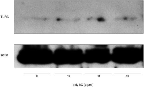 Figure 3 Western blot analysis. TLR3 is expressed in SW480; Cultured SW480 cells were treated with 0–50 µg/mL poly I:C for 24h and the cells were lysed. The lysate was subjected to Western blot analysis for TLR3 and actin. Expression of a small amount of TLR3 protein was detected even in cells without treatment with poly I:C. Significant upregulation of TLR3 protein by poly I:C was not observed.