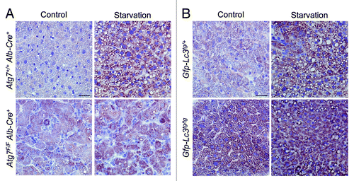 Figure 8. Immunohistochemical staining of LC3B is enhanced in frozen liver sections. Liver samples were isolated from Atg7+/+ Alb-Cre+ and Atg7F/F Alb-Cre+ mice (A) or from transgenic Gfp-Lc3tg/+ or Gfp-Lc3tg/tg mice (B). Some animals were fed normal chow (control), others underwent starvation for 48 h. After fixation in acetone, frozen sections were stained for LC3B using biotinylated mouse monoclonal anti-LC3B (clone 5F10, Nanotools, 1:1,000 [Atg7+/+ Alb-Cre+ and Atg7F/F Alb-Cre+ samples] or 1:30,000 [Gfp-Lc3tg/+ and Gfp-Lc3tg/tg samples]) and Vectastain ABC. Scale bar, 40 μm.