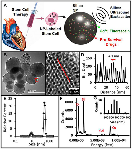 Figure 17 Schematic diagram of theranostic MSNs and characteristic of MSNs. (A) MSNs have impedance mismatch to backscatter ultrasound, MRI signal via Gd3+ and optical signal from fluo rescein. (B) TEM image of MSNs. (C) Enlarged TEM image of MSNs with 4.1 nm pores. (D) Red box in B indicates area imaged at higher magnification in C, line in C is representative of profile used to construct D. (E) DLS of MSNs. (F) EDS of MSNs shows expected peaks for silicon and oxygen as well as gadolinium from the secondary tag. (G) Histogram of MSN sizes from the TEM data in nm.