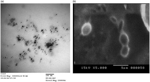 Figure 4. Transmission electron microscope (a) and scanning electron microscope (b) images of the selected nanoemulsion, F3.
