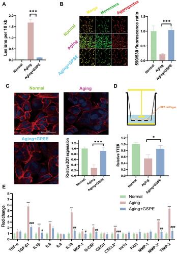 Figure 4 GSPE alleviated mitochondrial homeostasis, barrier function and SASP of aging RPE cells. (A) GSPE treatment significantly alleviated the mtDNA lesions, which was significantly increased in the aging RPE cells. n=3, ***: P<0.001. (B) After GSPE treatment, less monomer J1 stained, and the permeability of the damaged mitochondrial membrane was significantly improved. The J1 monomers were stained green and J1 aggregates were stained red. n=3, P <0.001. (C) GSPE could significantly improve the expression of ZO1 in the aging RPE cells. ZO1 was stained read and the nuclear was stained blue with DAPI. n=3, P <0.001. (D) GSPE treatment significantly improve the reinstate the TEER in the aging RPE cells. n=3, *: P<0.05. (E) Significantly expressed TGF-β1, IL1β, IL6, IL8, MCP-1, G-CSF, CXCL2, MMP3 and TIMP-2 was detected and GSPE could significantly alleviate the expressions of most dysregulated SASP factors comparing with the aging RPE cells. *: the comparison of aging and normal groups. #: the comparison of aging with GSPE treatment groups and aging groups. * and #: P <0.05, ** and ##: P <0.01, *** and ###: P <0.001.