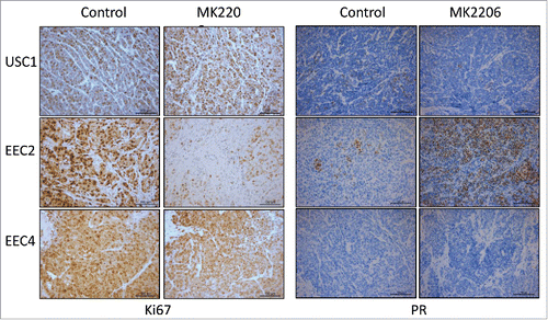 Figure 3. Levels of Ki67 and PR in PDX tumors. Immunostaining for Ki67 and PR on USC1, EEC2 and EEC4 was performed.