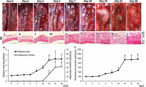 Figure 1. Time-dependent changes of the dilation ratio of the abdominal aorta and the number of adipocytes in the vascular wall. (a–i) Representative images of the abdominal aorta on days 0, 2, 3, 5, 7, 14, 21, and 28 after the induction of hypoperfusion (scale bar = 1.5 mm). (j–r) Representative images of the hematoxylin-eosin (HE) staining (scale bar = 200 µm). (s) Dilation ratio of the abdominal aorta and the number of adipocytes in the vascular wall. (t) Thickness of the vascular wall. Data are expressed as the mean ± SEM. *P < 0.05 versus day 0. Day 0 (n = 5), day 2 (n = 5), day 3 (n = 5), day 5 (n = 5), day 7 (n = 5), day 10 (n = 6), day 14 (n = 5), day 21 (n = 5) and day 28 (n = 7).