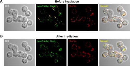 Figure 5 Lysosomal rupture induced by the photodynamic effect of RhoPro. (A) Internalized RhoPro was accumulated in lysosomes co-stained with the lysosome marker, LysoTracker Green. Yellow arrows indicate intact lysosomes. (B) After irradiation, lysosomal rupture occurred, and the fluorescence of LysoTracker Green and RhoPro decreased and appeared to diffuse in the cytoplasm. Magnification: 60× oil objective.Abbreviations: DIC, differential interference contrast; RhoPro, rhodamine-protamine.