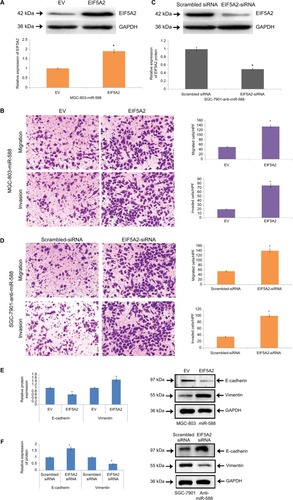 Figure 7 miR-588–influenced migration, invasion and EMT were partially blocked by causing alterations in levels of EIF5A2.Notes: (A) Western blot analysis for the expression of EIF5A2 in miR-588–overexpressing MGC803 cells followed by transfection with EV or EIF5A2 expression plasmid (*P<0.05 compared to EV). (B) In MGC-803 cells exhibiting overexpression of miR-588, overexpression of EIF5A2 increased the process of migration and invasion in cells (*P<0.05 compared to EV). (C) The SGC-7901 cells exhibiting lower miR-588 levels were transfected with scrambled siRNA or EIF5A2 siRNA, following which Western blot analysis was done for the expression of EIF5A2 (*P<0.05 compared to scrambled siRNA). (D) EF5A2 was knocked out in SGC-7901 cells, which was followed by recording the effects of miR-588 knockdown (*P<0.05 compared to scrambled siRNA). (E) The markers of EMT were studied in transfected MGC-803 and (F) SGC-7901 cells by Western blot analysis (*P<0.05 compared to scrambled siRNA).Abbreviations: EMT, epithelial–mesenchymal transition; EV, empty vector; HPF, high power field.