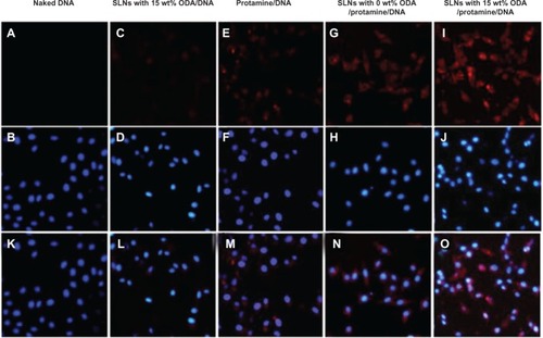 Figure 8 Fluorescent images after cells were incubated with fluorescent nanoparticles for 6 hours. The cells were treated with Hoechst 33342 (blue) to detect the nucleus and DNA was labeled by ROX (red).Notes: (A) is naked DNA. (C) is the DNA of SLNs with 15% ODA/DNA. (E) is the DNA of Protamine/DNA. (G) is the DNA of SLNs with 0 wt ODA/protamine/DNA. (B, D, F, H, J) are the nucleus corresponding to the above group. (I) is the DNA of SLNs with 15% Wt DA/protamine/DNA. (K–O) are the merged images of DNA with nucleus.Abbreviations: ODA, octadecylamine; SLNs, solid lipid particles; DNA, deoxyribonucleic acid.