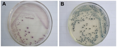 Figure 2 The specificity of IMP enrichment for Escherichia coli O157:H7. (A) E. coli O157:H7 will appear as aubergine colonies. (B) Non-E. coli O157:H7 will appear as blue-green colonies and no growth.