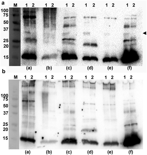 Figure 3. Immunoreactivity of normal human sera to A. actinomycetemcomitans and E. coli OMVs. Western blot analysis of reactivity of NHS from periodontally healthy individuals with (a) OMVs obtained from the A. actinomycetemcomitans strains D7SS (wild-type; lane 1), and D7SS ompA1 ompA2 (lane 2), and (b) OMVs obtained from the A. actinomycetemcomitans strains SA3138 (wild-type; lane 1), and SA3139 (LPS lacks the O-antigen polysaccharide part; lane 2). The NHS samples a-f were used for immunodetection as indicated, and include sera known to exhibit high (a, and f) and low (b) reactivity, respectively, towards recombinant A. actinomycetemcomitans leukotoxin, and one from a confirmed A. actinomycetemcomitans-negative individual (e). Samples equal to 10 μg protein were applied on the gels. The reactive band corresponding to A. actinomycetemcomitans OmpA1 is indicated with an arrowhead. LPS is detected as a diffuse, high-molecular smear pattern for serum sample (b), when assessing SA3138 OMVs. The sizes (kDa) of the proteins in the pre-stained molecular weight marker (M) are indicated along the left sides