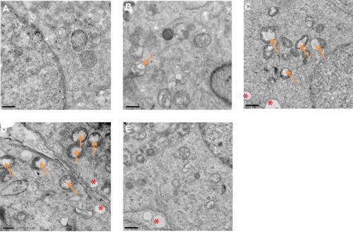 Figure 3 La2O3 NPs and MPs influence on ultrastructure of testis. (A) Control. (B) La2O3 NPs (5 mg/kg). (C) La2O3 NPs (10 mg/kg). Arrows indicate mitochondria and vacuoles in mitochondria. (D) La2O3 NPs (50 mg/kg). (E) La2O3 MPs (50 mg/kg) (×8000). The control and La2O3 MPs groups showed no morphological changes, but vacuolar changes in the mitochondria were detected in the NM and NH groups (arrows). In affected tubules, vacuolation of the seminiferous epithelium could be detected (red asterisk).