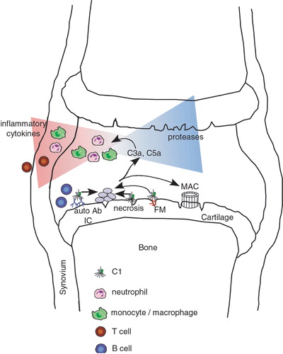 Figure 2. Schematic diagram of possible contributions of the complement system to development of rheumatoid arthritis(RA) in a joint. Complement can be activated in several ways in the RA joint. Examples are deposited autoantibodies and immune complexes (IC), apoptotic and necrotic cells, certain cartilage molecules such as fibromodulin (FM) exposed upon initial cartilage damage. Activation of complement leads to a release of proinflammatory anaphylatoxin C5a that attracts and activates neutrophils and macrophages. These cells in turn release proteases and cytokines attracting T and B lymphocytes and other inflammatory cells, further fuelling the process of inflammation. As a result of complement activation membrane attack complex (MAC) is formed and has a plethora of effects on cells even at sublytic concentrations.