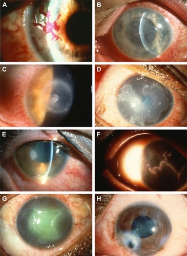 Figure 1 Representative images of various corneal damages due to HSV1 infection.