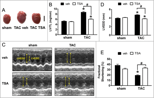 Figure 1. HDAC inhibition with TSA prevents pathological cardiac remodeling and dysfunction. (A) Representative hearts of mice that underwent sham or TAC surgery, followed by injection with TSA (0.6 mg/kg/day) twice daily for 4 weeks. Scale bar = 5mm. (B) Graphs of left ventricular weight/ tibial length ratio (LV/TL). Data are expressed as means ± SEM; * P < 0.05 vs. sham with the same treatment; # P < 0.05; n = 9–10/ group. (C) Representative M-mode echocardiograms from sham and TAC mice with vehicle or TSA. Yellow arrows indicate differences in LV chamber dimensions. (D) Quantification of left ventricular end diastolic dimension (LVEDD). (E) Fractional shortening (FS) of sham and TAC mice with vehicle or TSA treatment. Data are expressed as means ± SEM; * P < 0.05 vs sham; # P < 0.05; n = 9-10/ group.