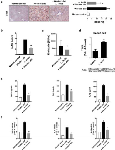 Figure 2. Gut-Liver axis analysis and pro-inflammatory cytokines. (a) Immunohistochemical analyses for CD68 in representative cases. ×400. (b) NAFLD Activity Score (NAS). (c) Stool endotoxin level. (d) Trans-epithelial electrical resistance (TEER) measurement. (e) Enzyme-linked immunosorbent assay. (f) Real-time reverse transcription-polymerase chain reaction. *p < 0.05, **p < 0.001