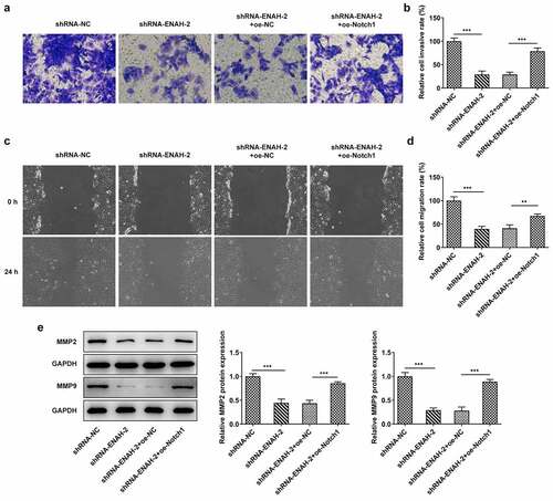 Figure 7. Notch1 overexpression restores the inhibitory effect of ENAH knockdown on HCC cell migration and invasion. (a-b) Transwell assay was to evaluate the invasive ability of SNU-387 cells. (c-d) Wound healing assay was to estimate cell migration in HCC. (e) MMP2 and MMP9 expression were examined by Western blot. **P < 0.01, ***P < 0.001. ENAH, Enabled homolog. MMP2, matrix metallopeptidase 2. MMP9, matrix metallopeptidase 9. Notch1, Notch receptor 1.