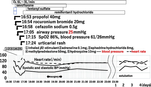 Figure 1. Clinical course. The first symptoms of bronchospasm arose at 11 min after venous injection of propofol and rocuronium, followed by cefazolin sodium 4 min later. After the administration of inhaled β2-stimulant, adrenaline, ephedrine hydrochloride, methylprednisolone, and hydroxyzine, bronchospasm disappeared and vital signs became stable.