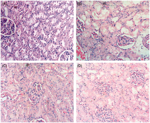 Figure 5. Histopathology of mouse kidney. (A) normal (B) cisplatin alone (16 mg/kg); (C) cisplatin and silymarin (100 mg/kg); (D) cisplatin and AMF (250 mg/kg) treated mice. The slides were observed under light microscope at 400× magnification.