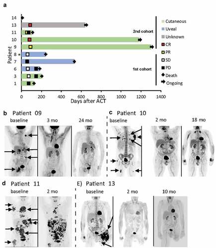 Figure 2. Clinical responses. Swimmers plot (a, * Date of progressive disease unknown) and PET/CT scans for patients 9 (b), 10 (c), 11 (d) and 13 (e) are shown. Arrows indicating several FDG-avid lesions. Patient 11 had previously undergone amputation of the left leg because of progressing melanoma lesions.