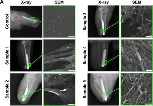 Figure 7 In vivo evaluation of the microtopographic/nanotopographic coated titanium implants. (A) Radiographs of the control and nanocoated titanium implants 8 weeks following operation. Representative SEM images of the extracted implants surface are presented. Scale bar, 25 μm. (B) Corical layer thickness (mm) in the zone of the bone–implant contact. Data are presented as mean ± SD. (C) Osseointegration strength for the control and experimental animals. Data are presented as mean ± SD.Note: ***P<0.001.Abbreviation: SEM, scanning electron microscopy.